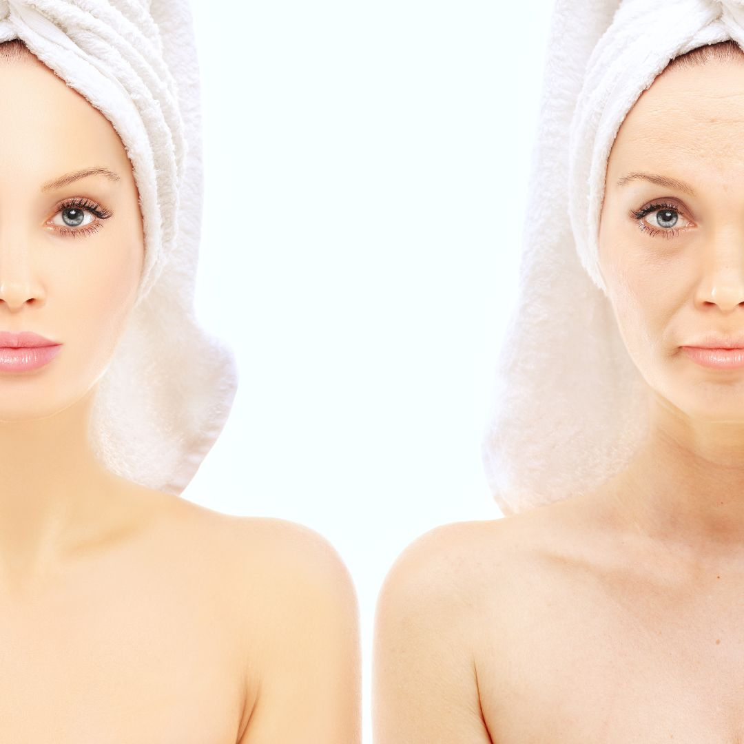 facial-liposuction-korea
