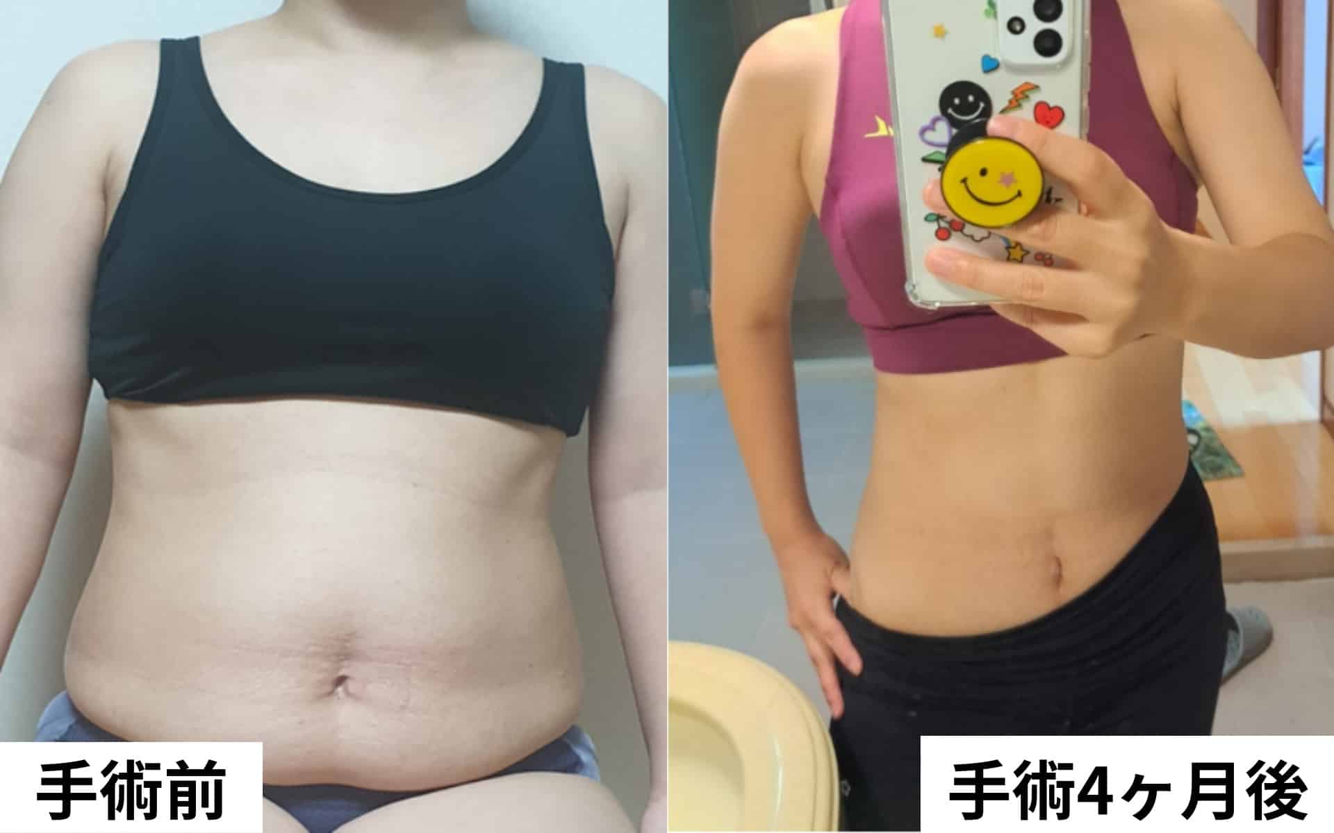 お腹の脂肪を簡単かつ迅速に減らす方法、医師がお教えします。 I 