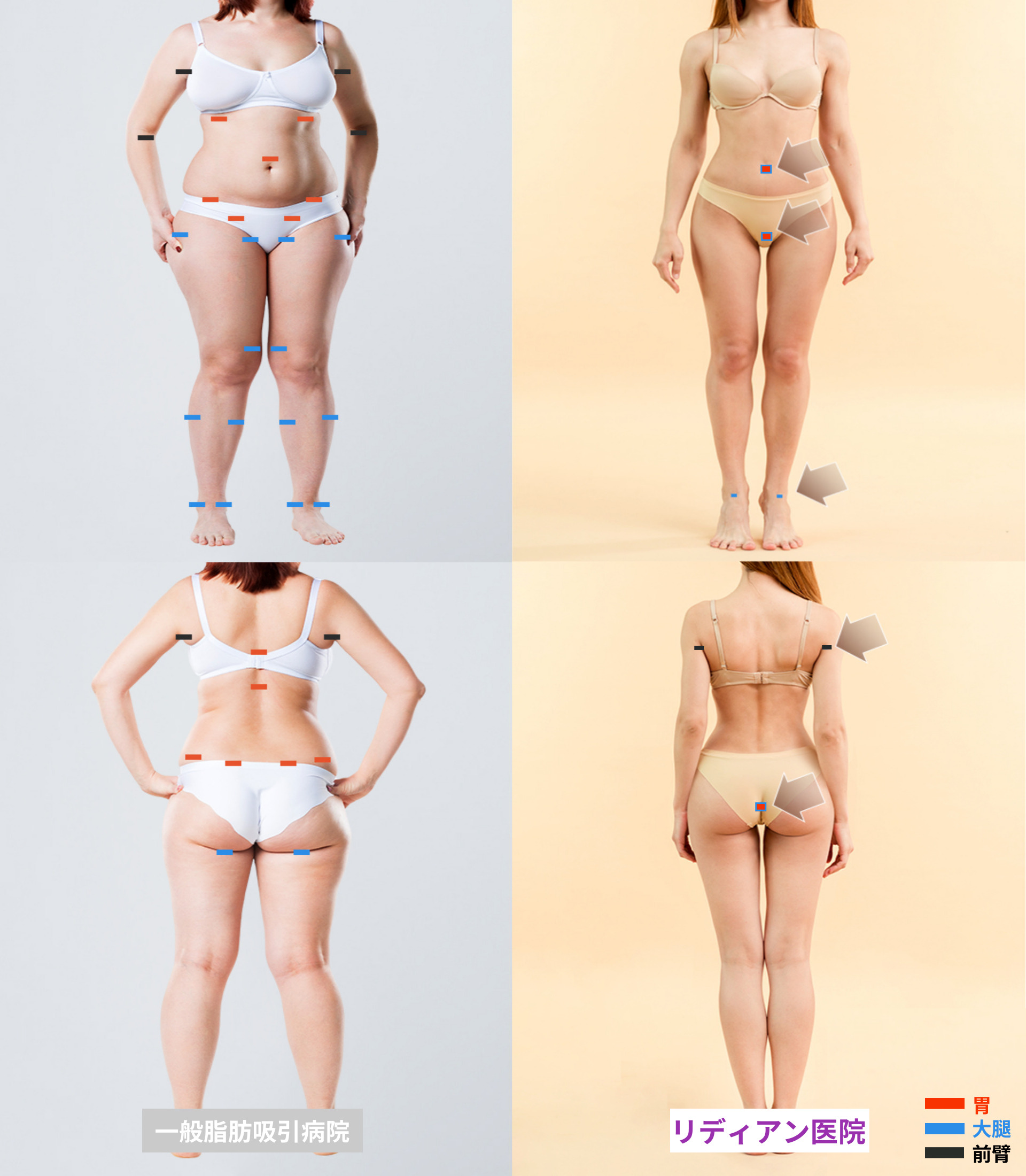 韓国芸能人が選んだウェディングドレスと体型管理方法 I リディアンクリニック, image size:1920x2200