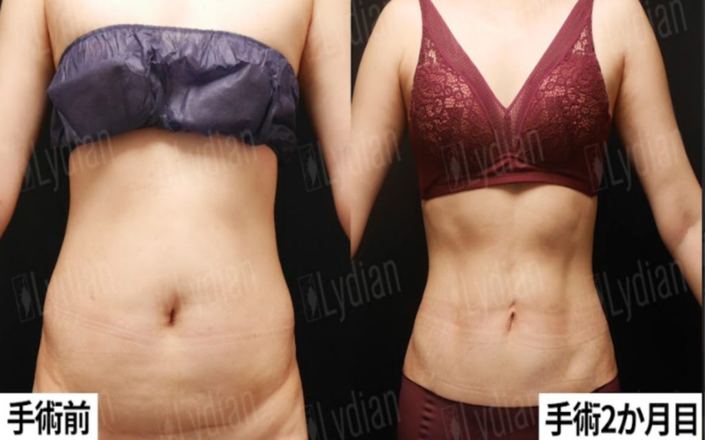 女性ダイエット40代
