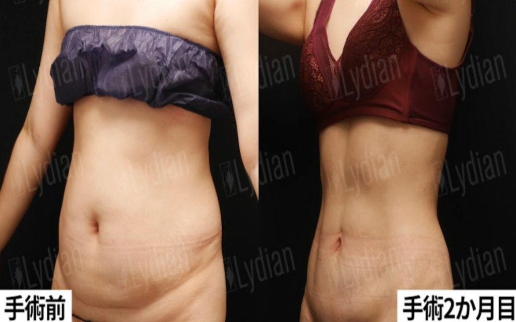40代女性ダイエット