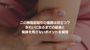二の腕脂肪吸引 傷痕 韓国リディアンクリニック リディアンクリニック 二の腕脂肪吸引 ワンホール二の腕脂肪吸引 韓国脂肪吸引 (7)