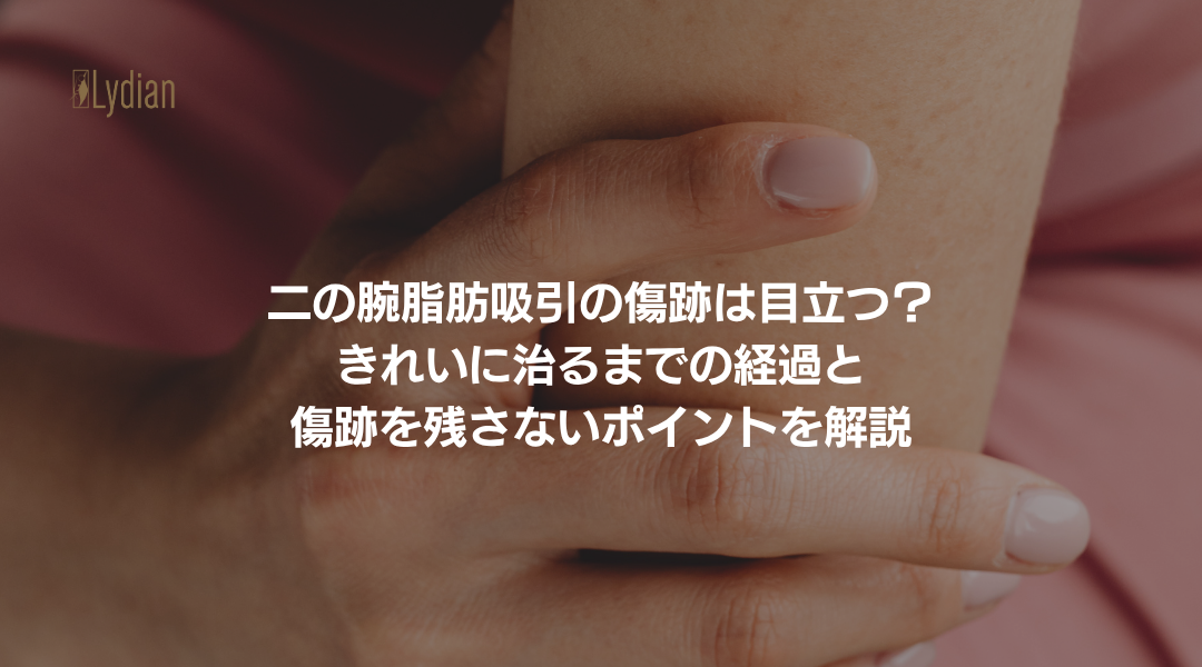 二の腕脂肪吸引 傷痕 韓国リディアンクリニック リディアンクリニック 二の腕脂肪吸引 ワンホール二の腕脂肪吸引 韓国脂肪吸引 (7)
