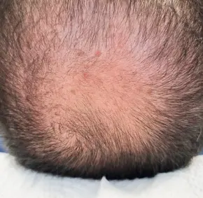 hl30
