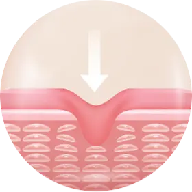 Close-up of rejuvenating non surgical facial treatment