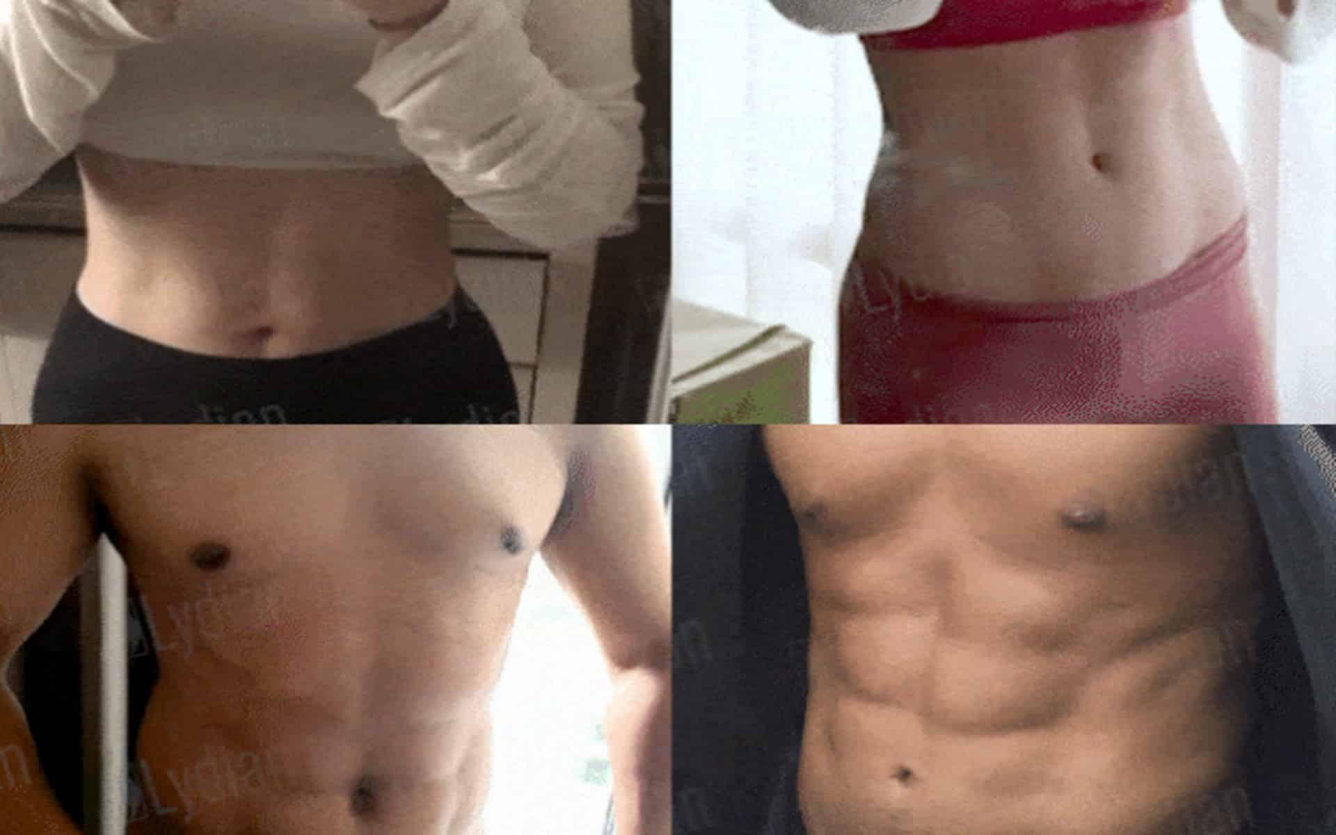 男性和女性腹部整形手術