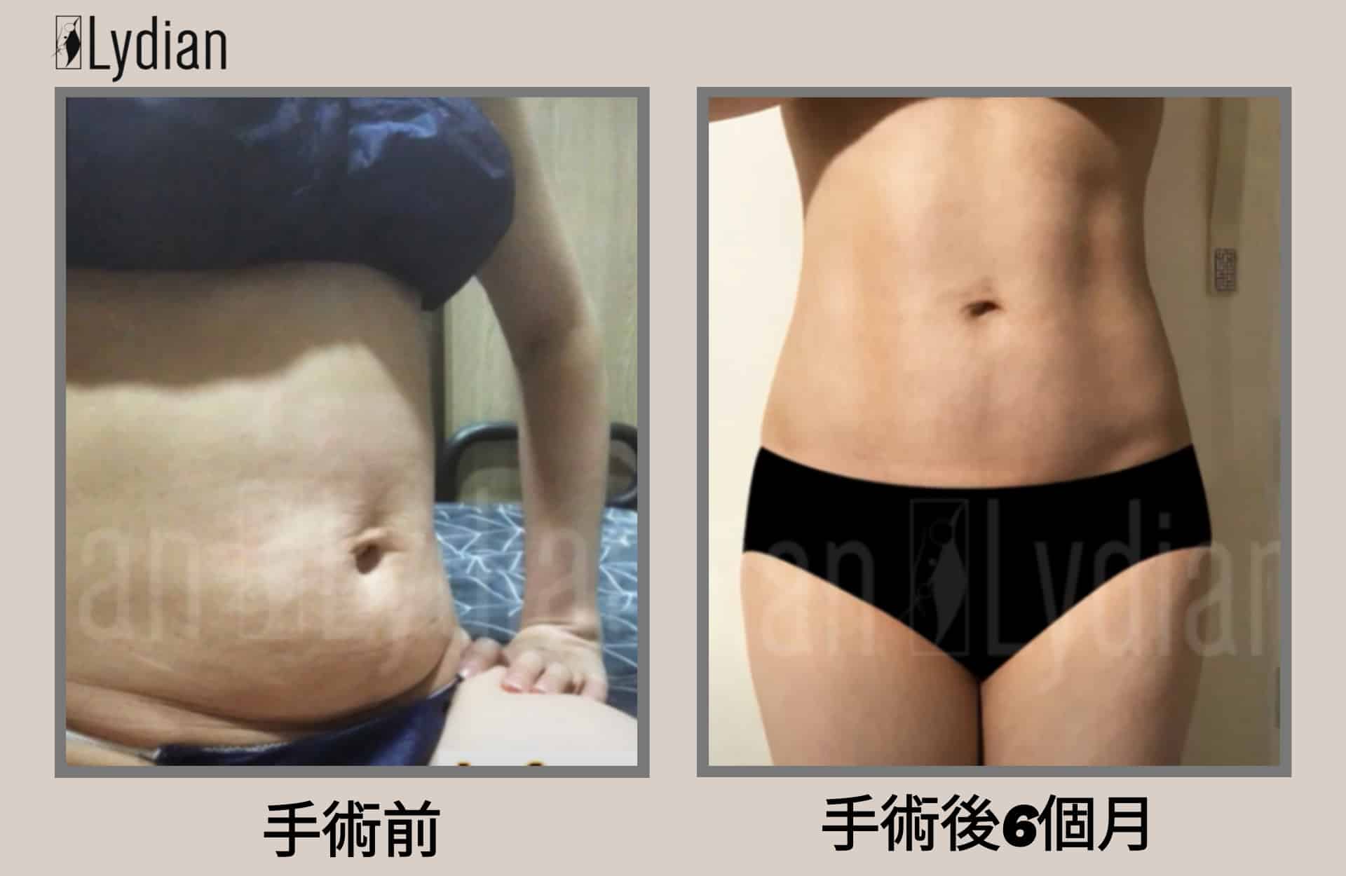 女性腹肌