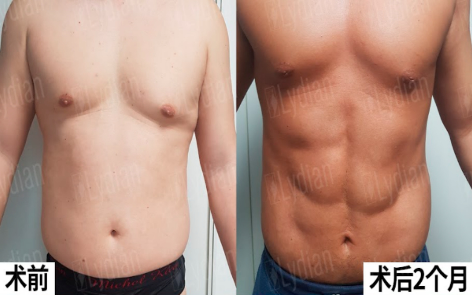 男士腹肌