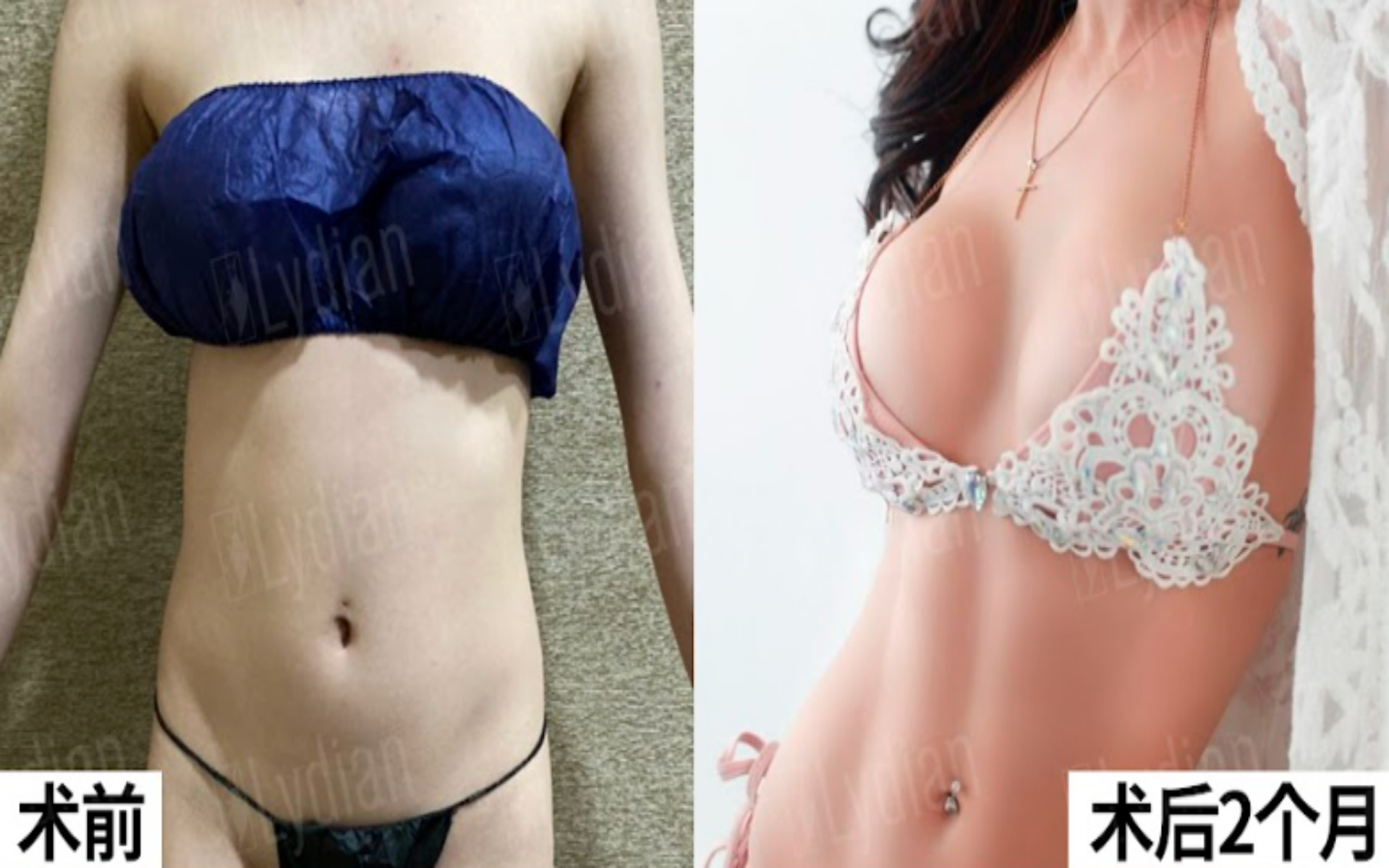 女性腹肌