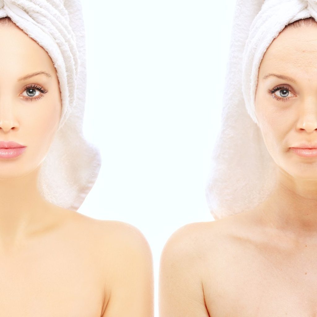 facial-liposuction