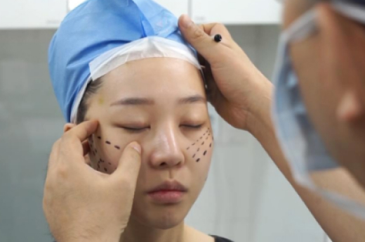 chin lipo recovery time