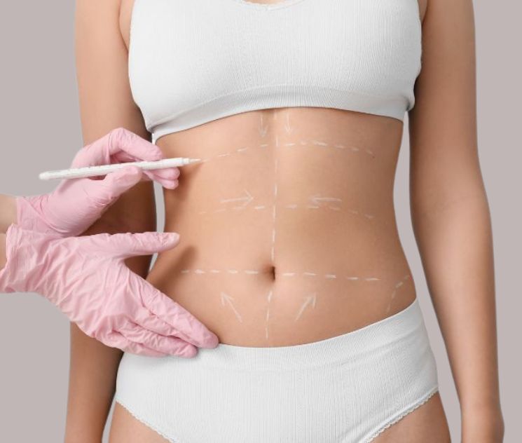 how much does liposculpture cost