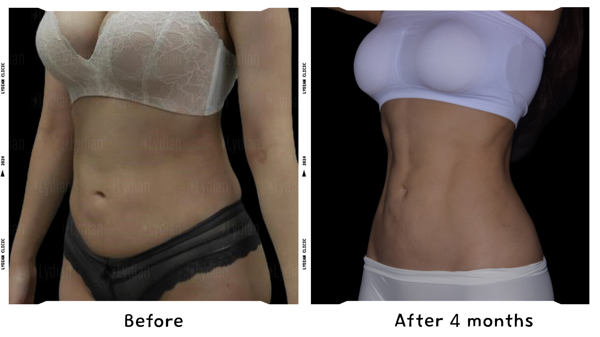 change of fat belly to slim belly