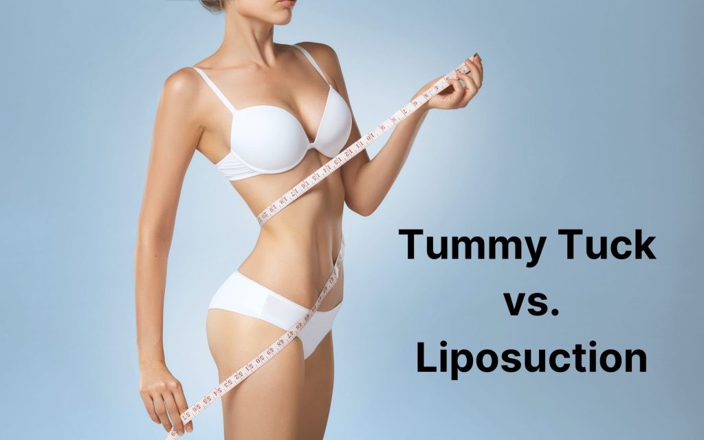 tummy tuck vs liposuction