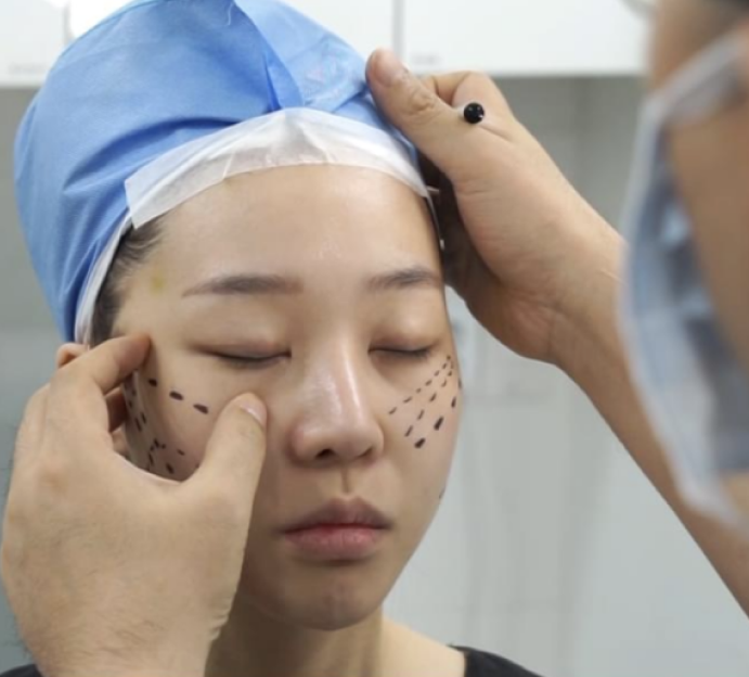 woman face is marked with straight black dotted line