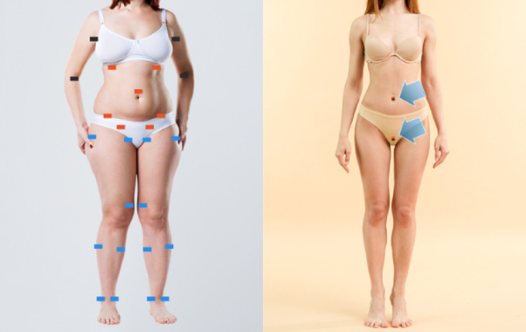 converting fat body to slim body