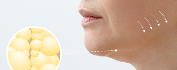 indicating sagging fat in cheek bone