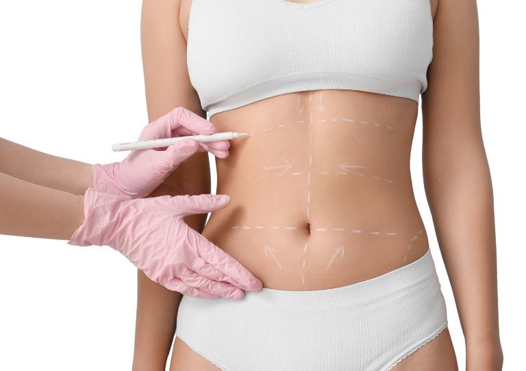 how much does liposculpture cost
