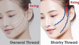 fixing general thread and sharky thread