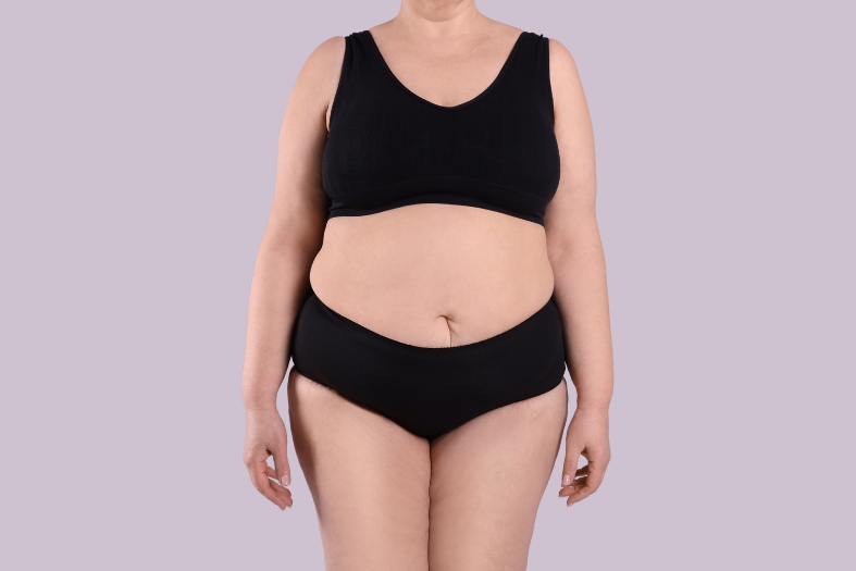 woman belly and breast before mommy makeover