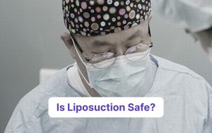how safe is liposuction