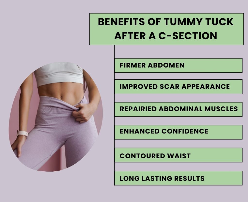 benefits of tummy tuck after c-section