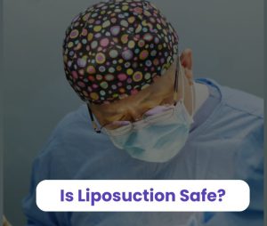 is liposuction safe
