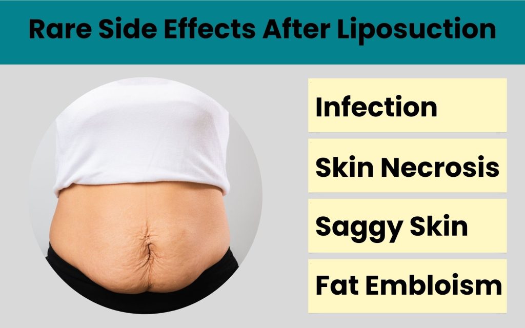 rare side effects after liposuction infographics