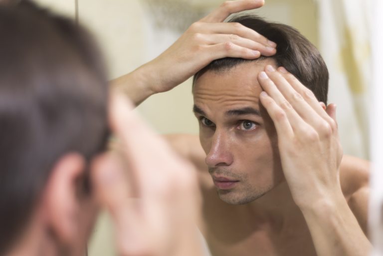 Non-Surgical Hair Regrowth