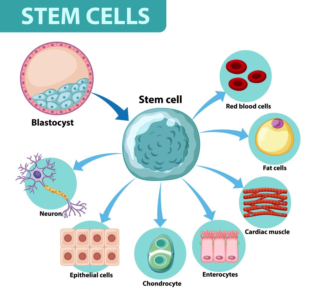 stem cell therapy