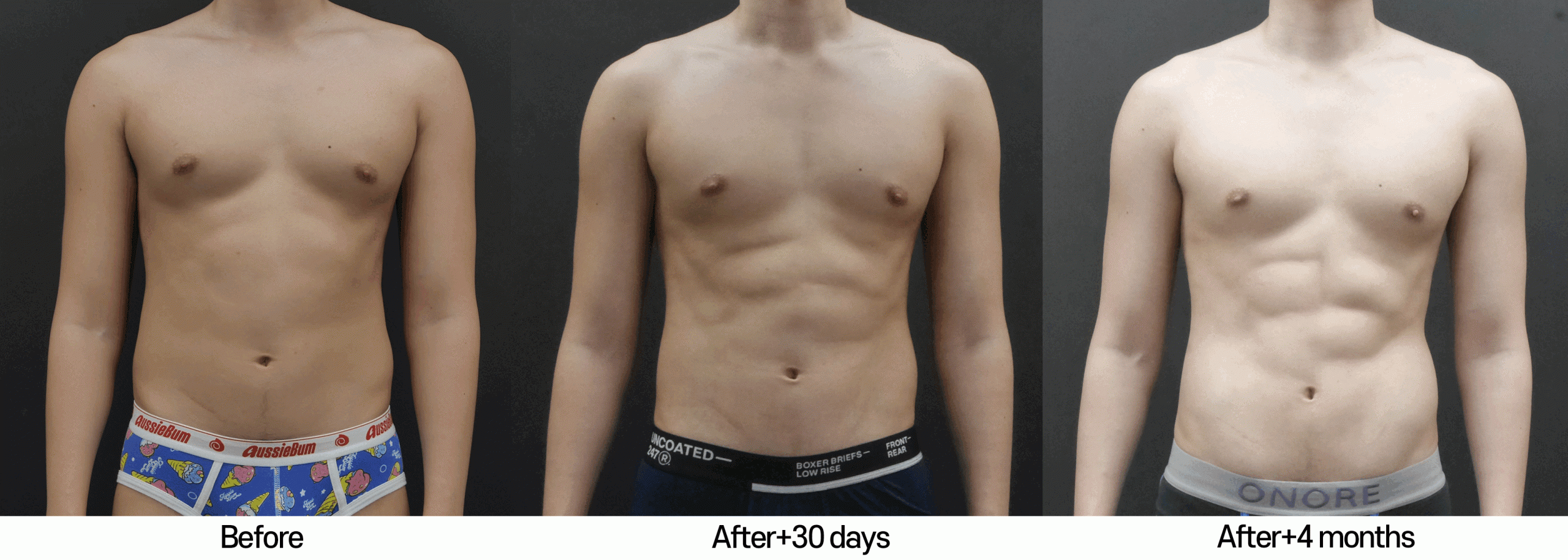 male-ab-etching-before-and-after