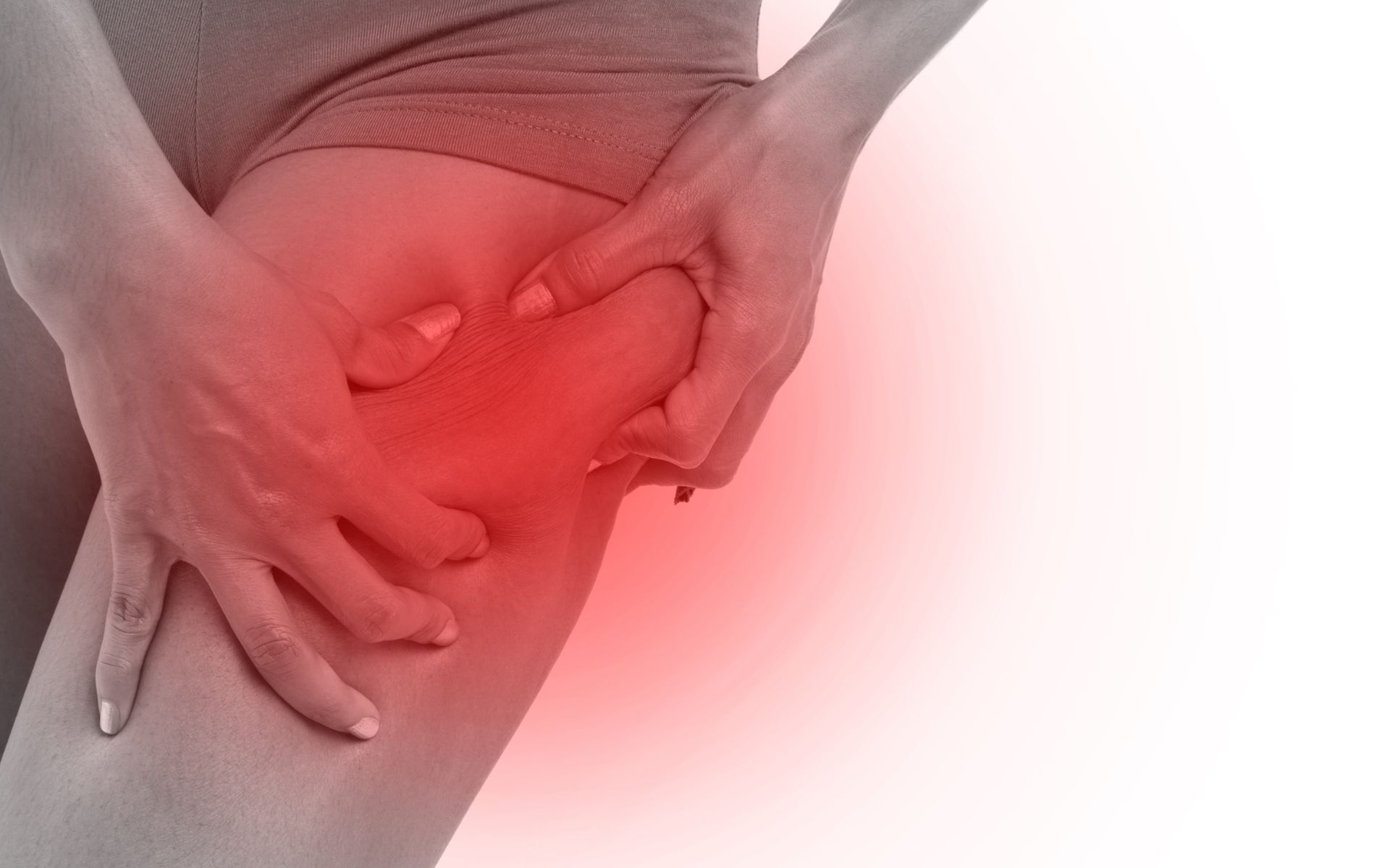 liposuction scars on thighs