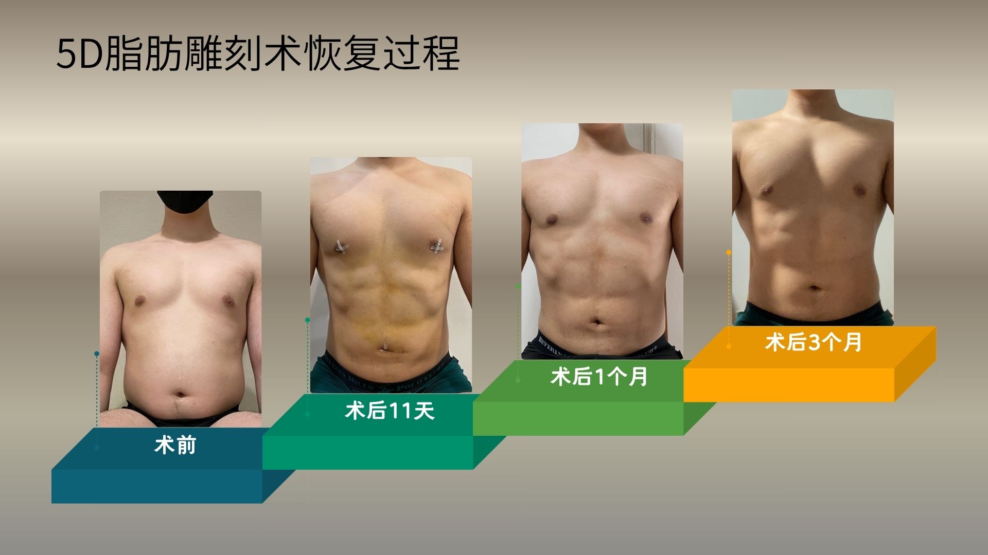恢復期總結圖